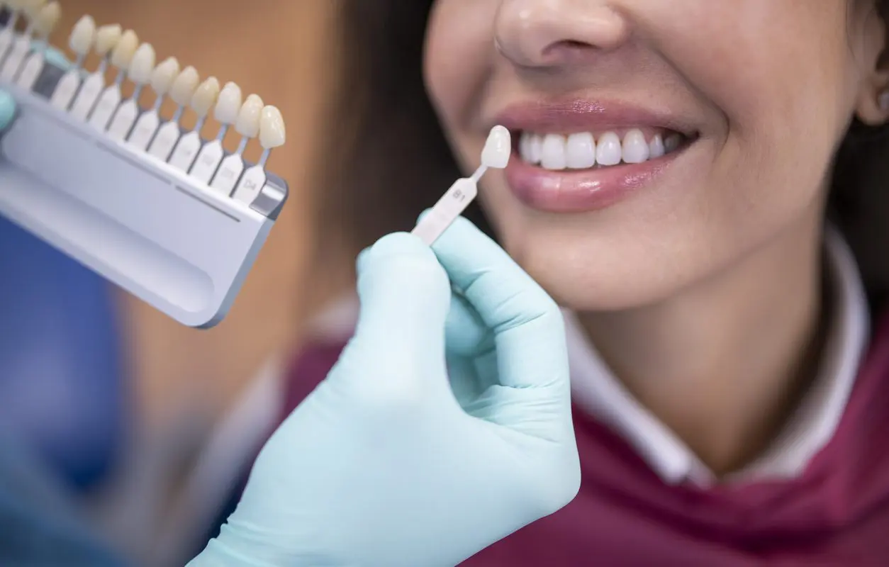 The Benefits of Dental Implants