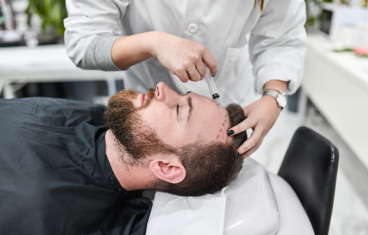Comprehensive Guide to Hair Transplants